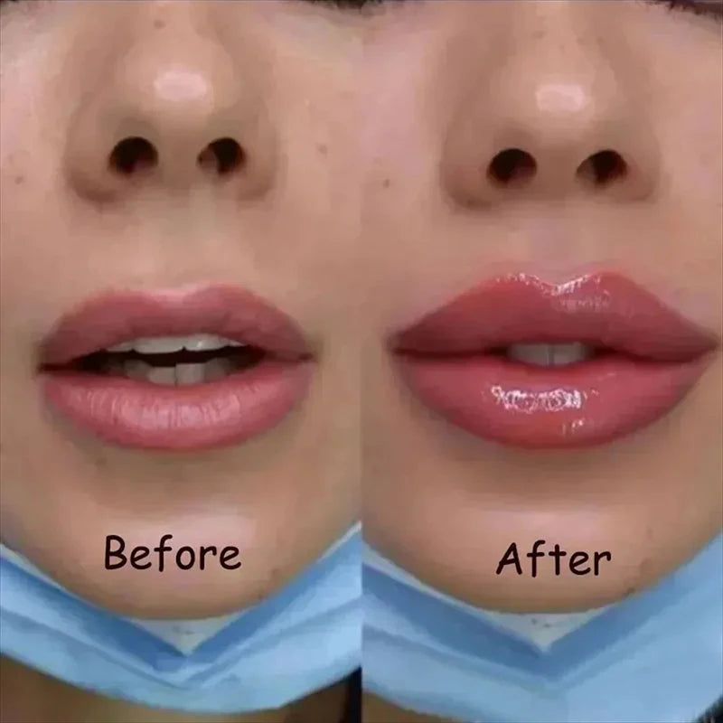 Anti-Wrinkle Lip Plumper Gloss