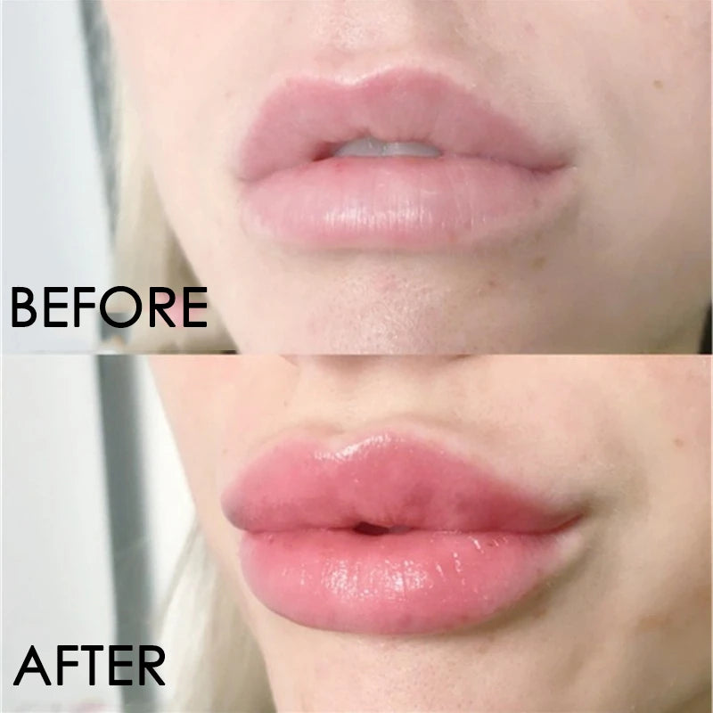 Collagen Lip Plumper & Care Mask
